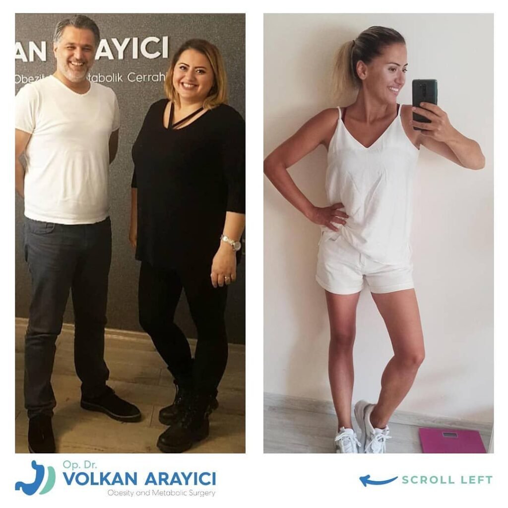 Bariatric Surgery Turkey