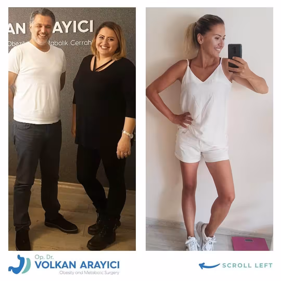 Bariatric Surgery Turkey