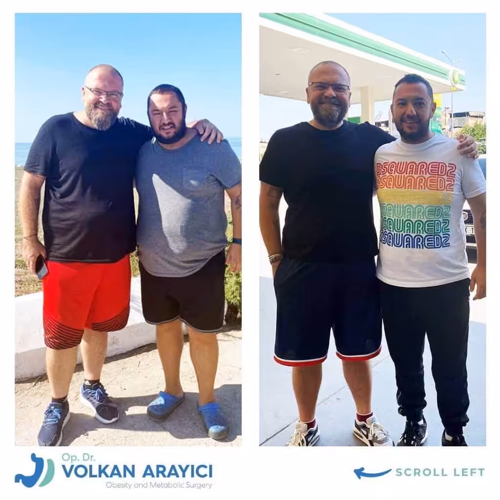 El Verdadero Costo de la Cirugía de Manga Gástrica en Turquía: Una Guía Completa de Precios 2026 Cuánto cuesta una Manga Gástrica