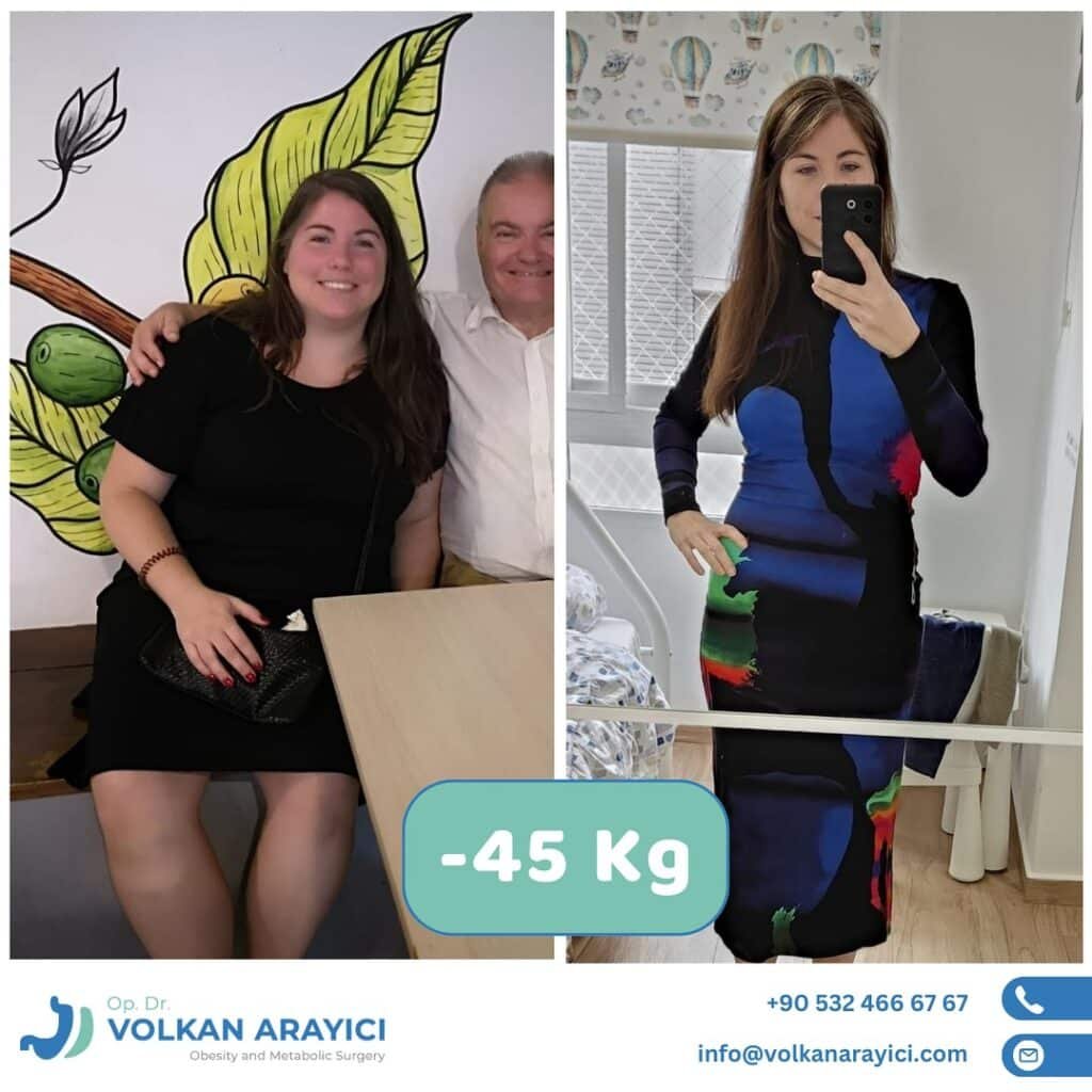 Gastric Bypass Turkey Package