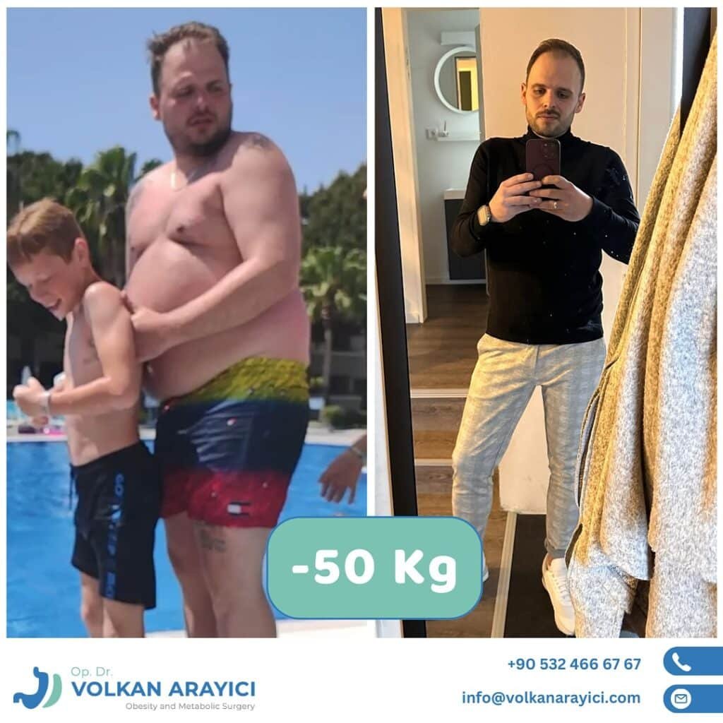 Gastric Reduction Turkey Package