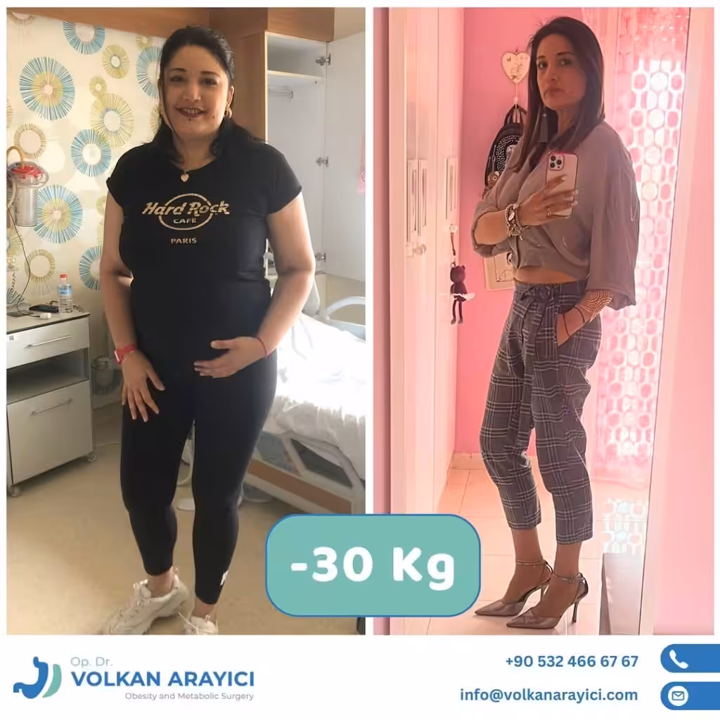 Gastric Sleeve Turkey Package Gastric sleeve Turkey All-Inclusive package