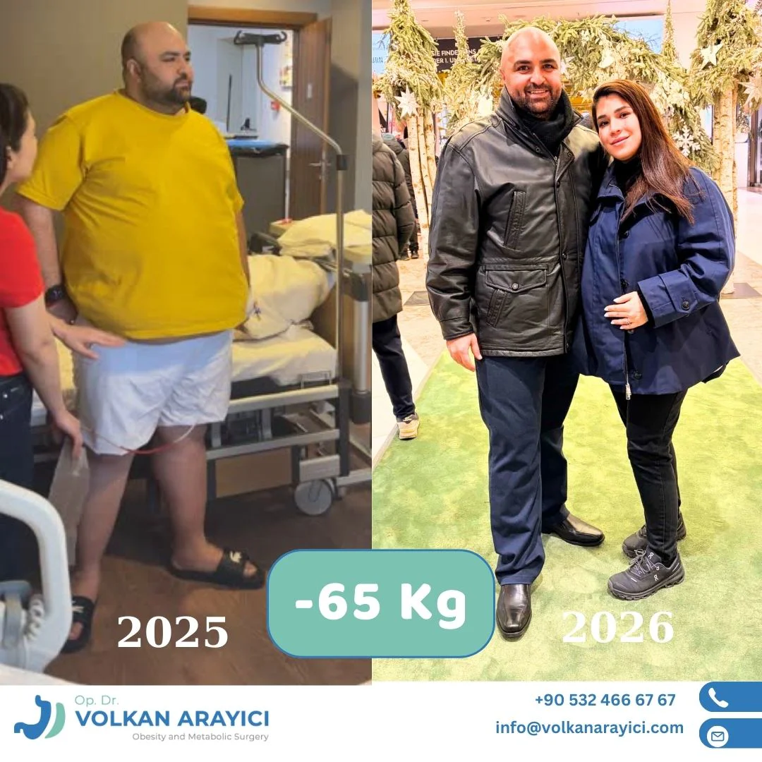 Magenverkleinerung Türkei vorher nachher