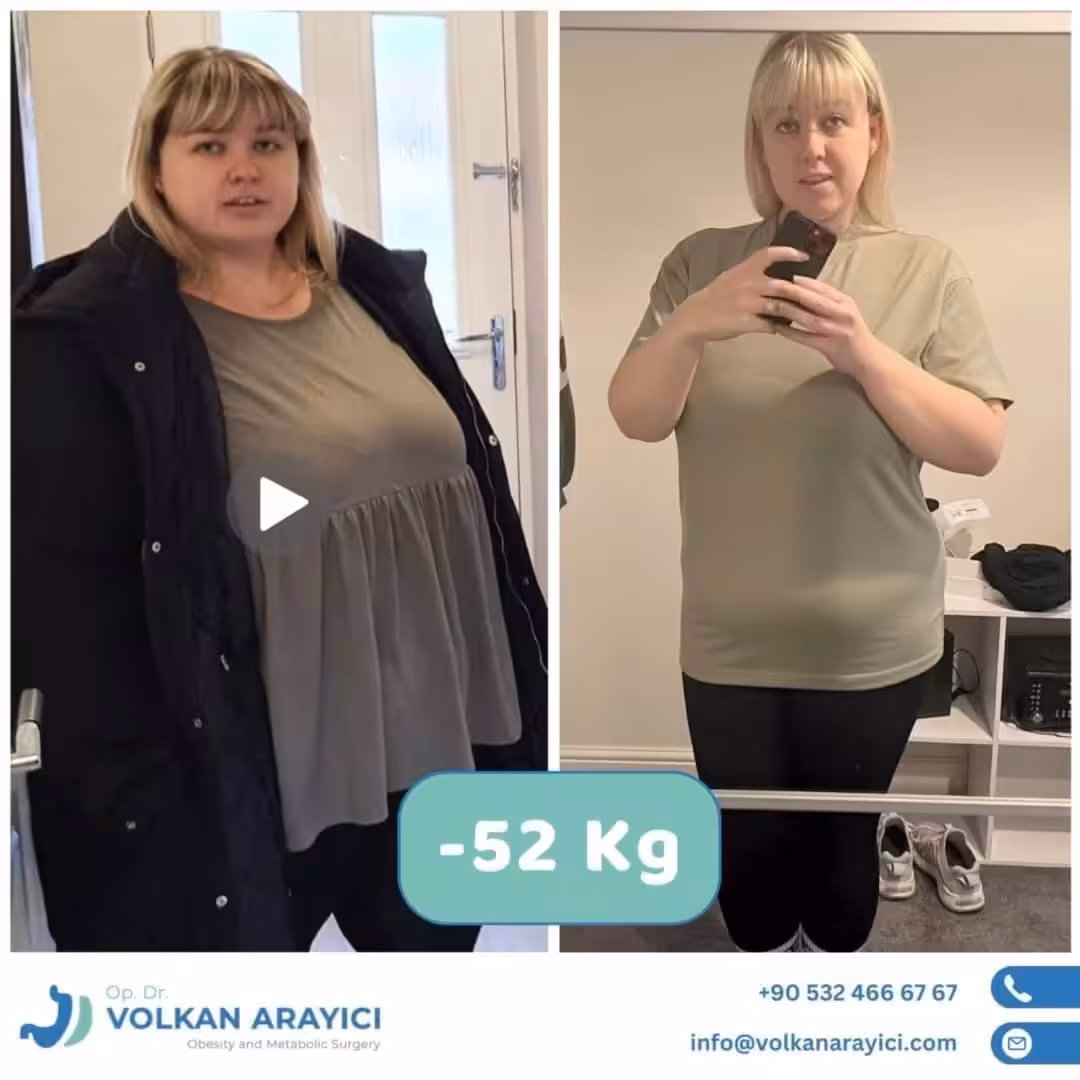 Paquete de Reducción Gástrica Turquía