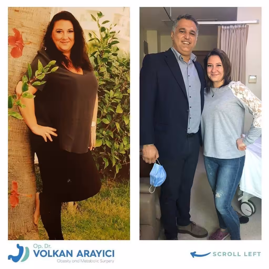 costos de cirugía gástrica en Turquía