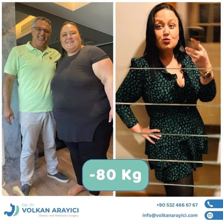 magen op türkei beste klinik