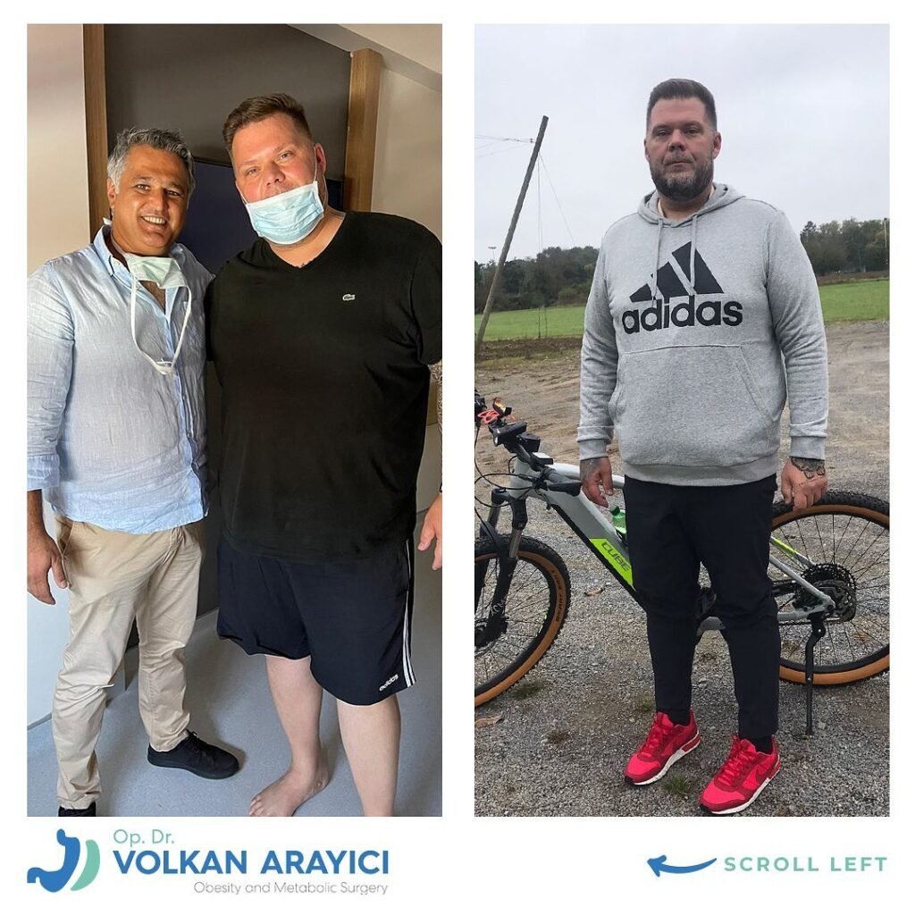 magenoperationen in der türkei