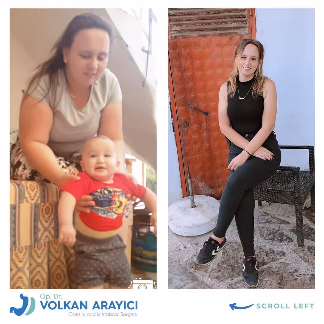 magenverkleinerung kosten Türkei