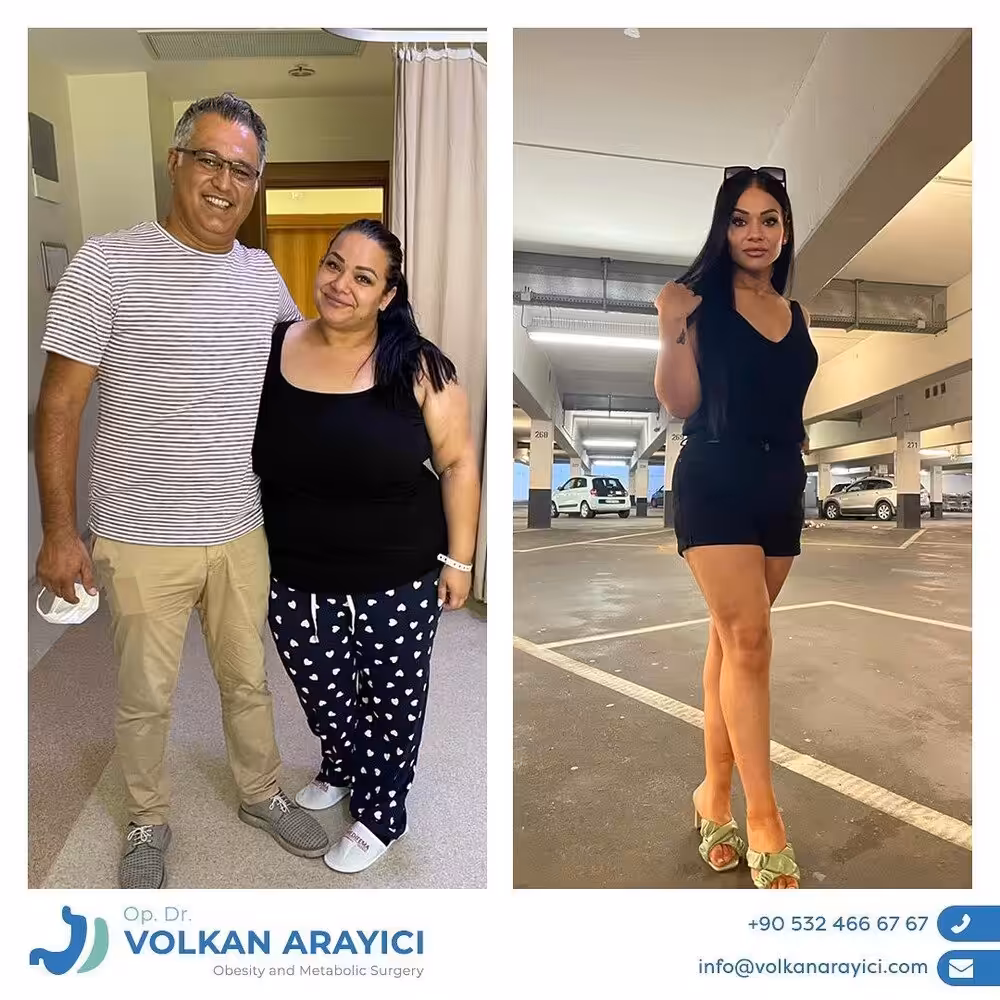 weight gain after gastric sleeve surgery